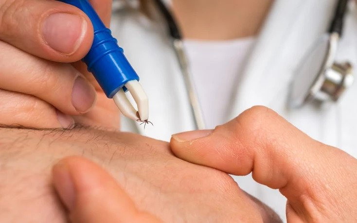 Áttörés jön a Lyme-kór diagnózisában