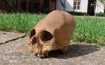 Csongrádon került elő az első magyarországi torzított koponya