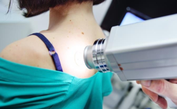 Az anyajegyszűrés ideális időpontja